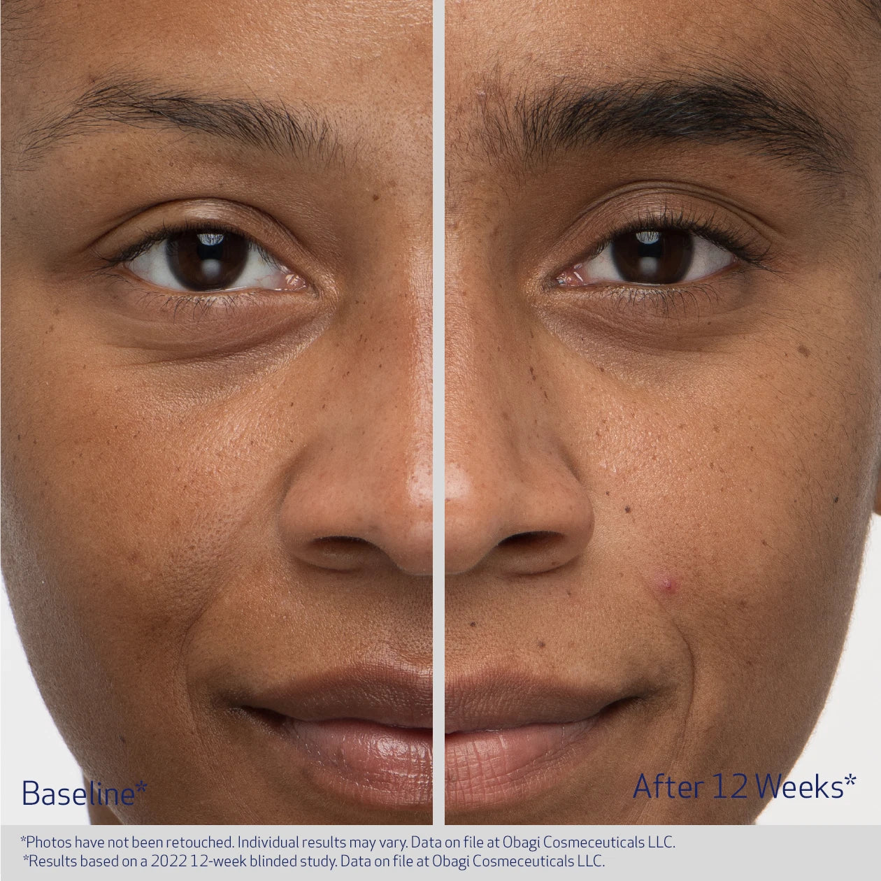 Eyebrow Boosting Serum Nu-Cil